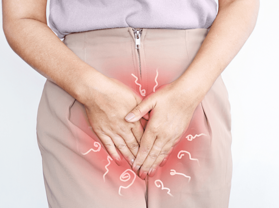 candidiasis vaginal